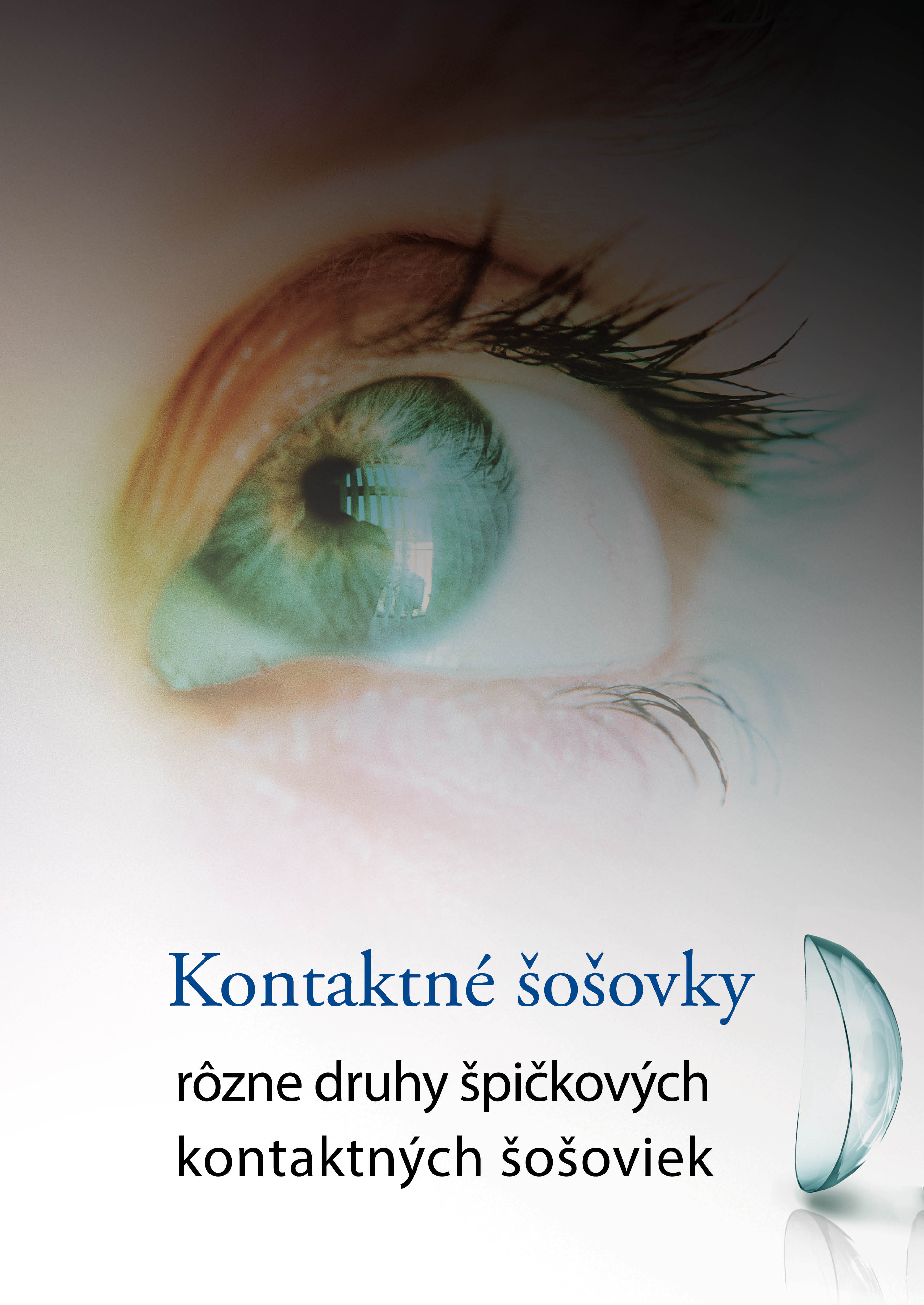 šošovky