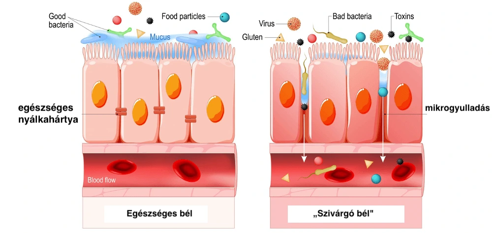 IBS-preklad