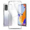 eng pl Ringke Fusion Cover Case with Gel Frame for Xiaomi Redmi Note 11 Pro 5G 11 Pro 5G 11 Pro transparent F624E52 95519 2