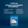 Joint Complex 30 sáčků lesní ovoce (Chrupavky, kosti, pojivová tkáň, funkce svalů) (Varianta Joint Complex 30 sáčků lesní ovoce (Chrupavky, kosti, pojivová tkáň, funkce svalů))