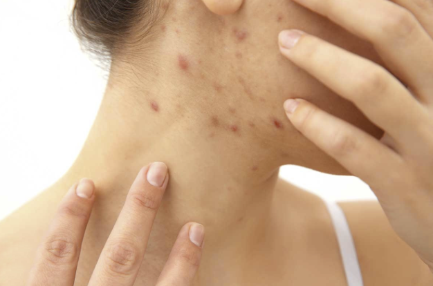 Na problémy s citlivou pletí je i řešení