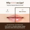 Dr. Reju All Advanced PDRN Rejuvenating Lip Serum 10ml3
