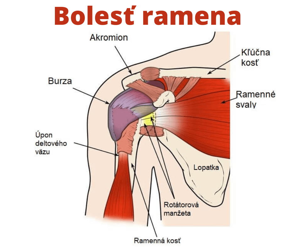 Bolesť ramena: Príznaky, príčiny a liečba