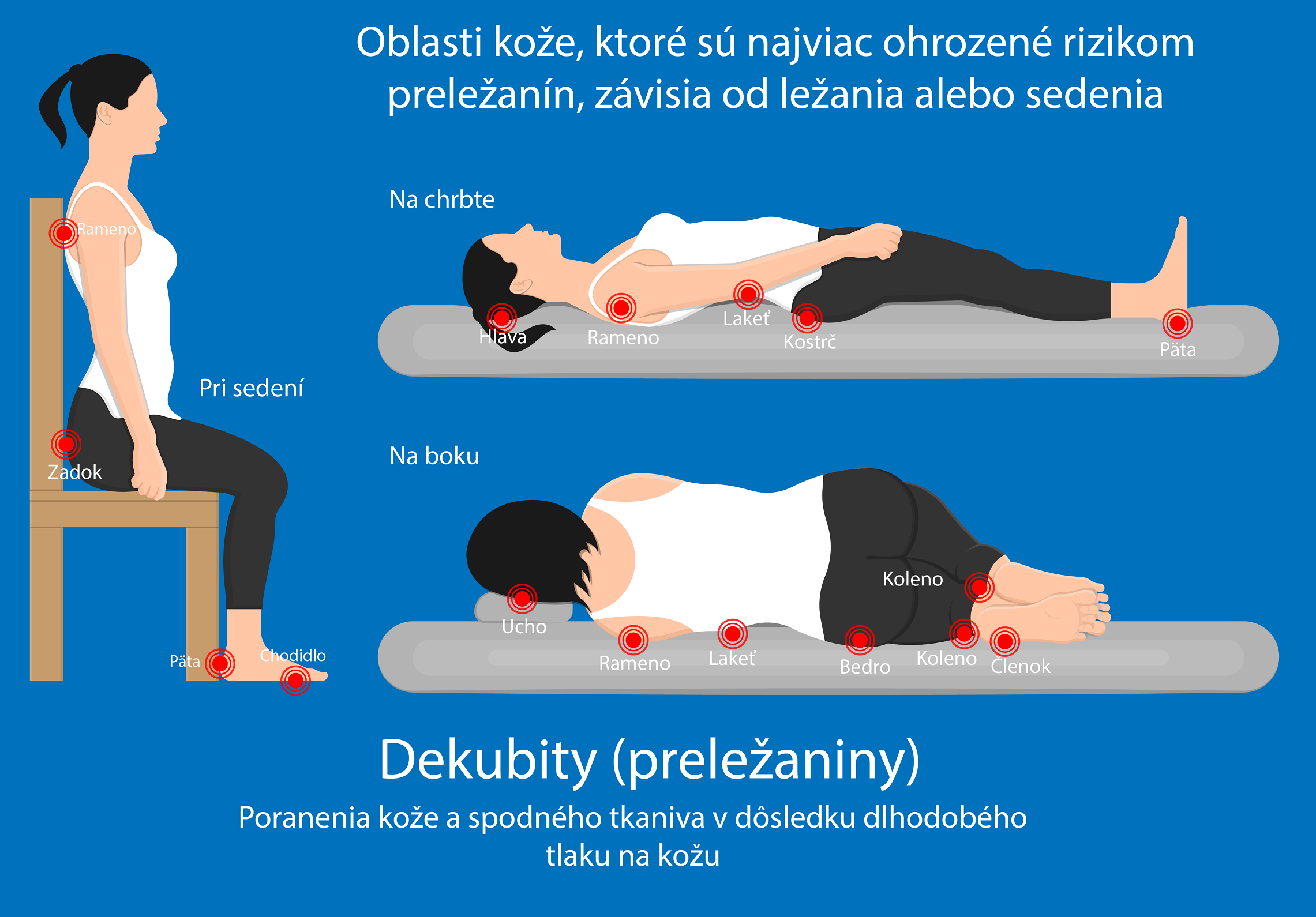 Dekubity (preležaniny): Príčiny, príznaky a liečba