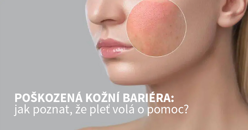 POŠKOZENÁ KOŽNÍ BARIÉRA: JAK POZNAT, ŽE PLEŤ VOLÁ O POMOC?