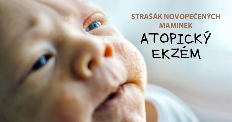 Z DENÍKU MÁMY: STRAŠÁK NOVOPEČENÝCH MAMINEK – ATOPICKÝ EKZÉM