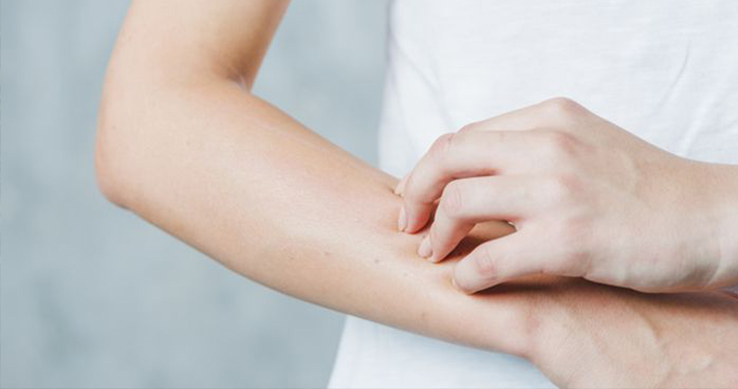 TRÁPÍ VÁS CITLIVÁ A ALERGICKÁ POKOŽKA? ŠETRNÁ A EKOLOGICKÁ DROGERIE, KTEROU SI ZAMILUJETE