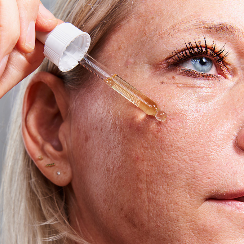 retinol-v-kosmetice--co-to-je--jak-funguje-a-pro-koho-je-vhodny