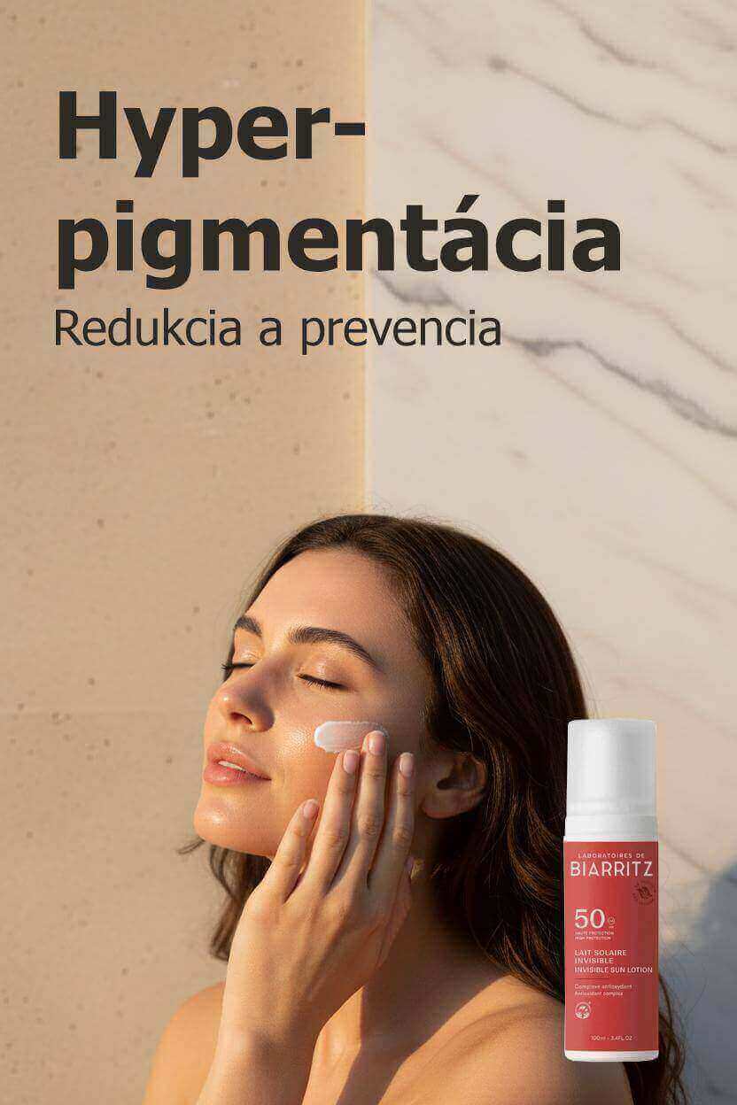 hyperpigmentácia