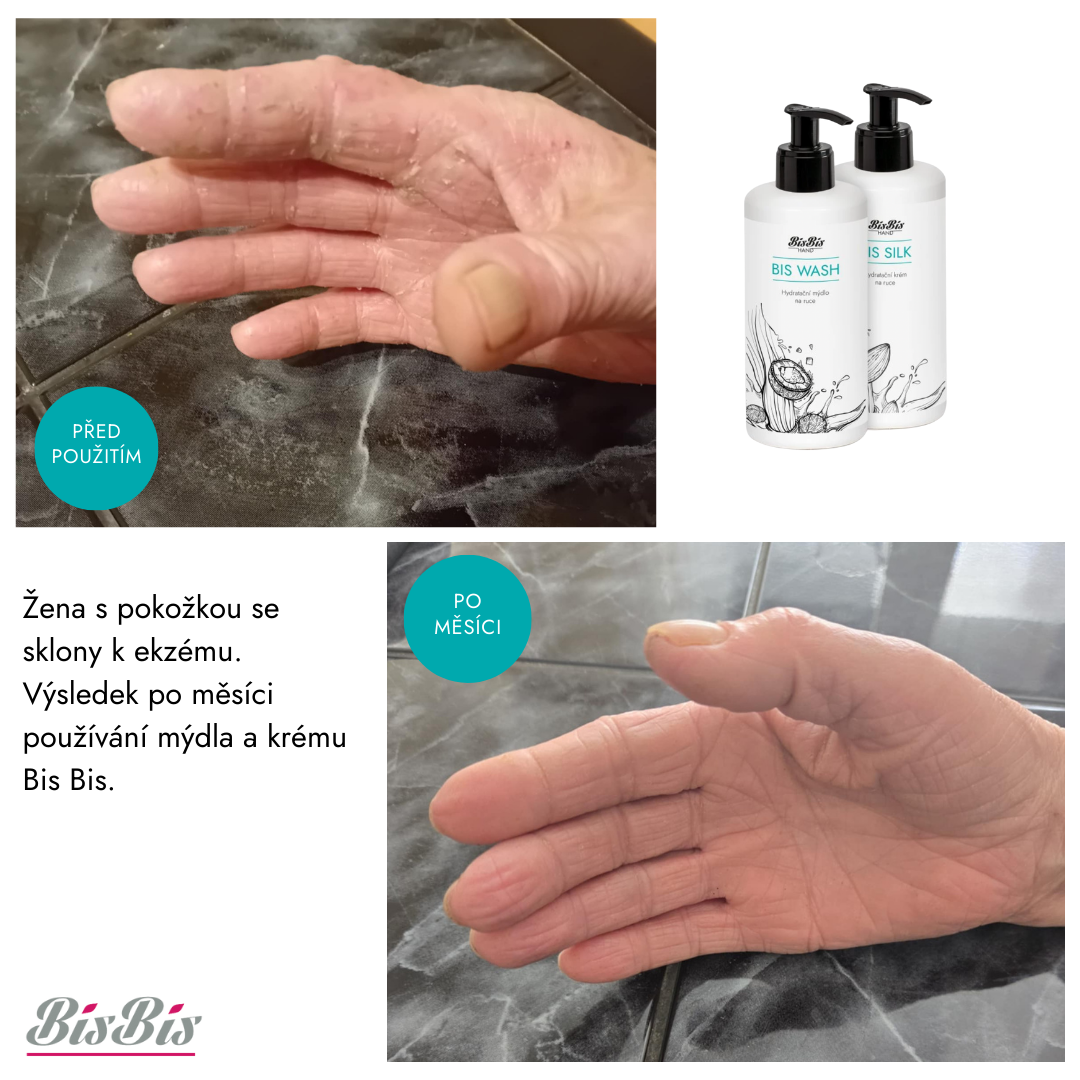 Sada péče o ruce – viditelné zlepšení podrážděné pokožky na rukou