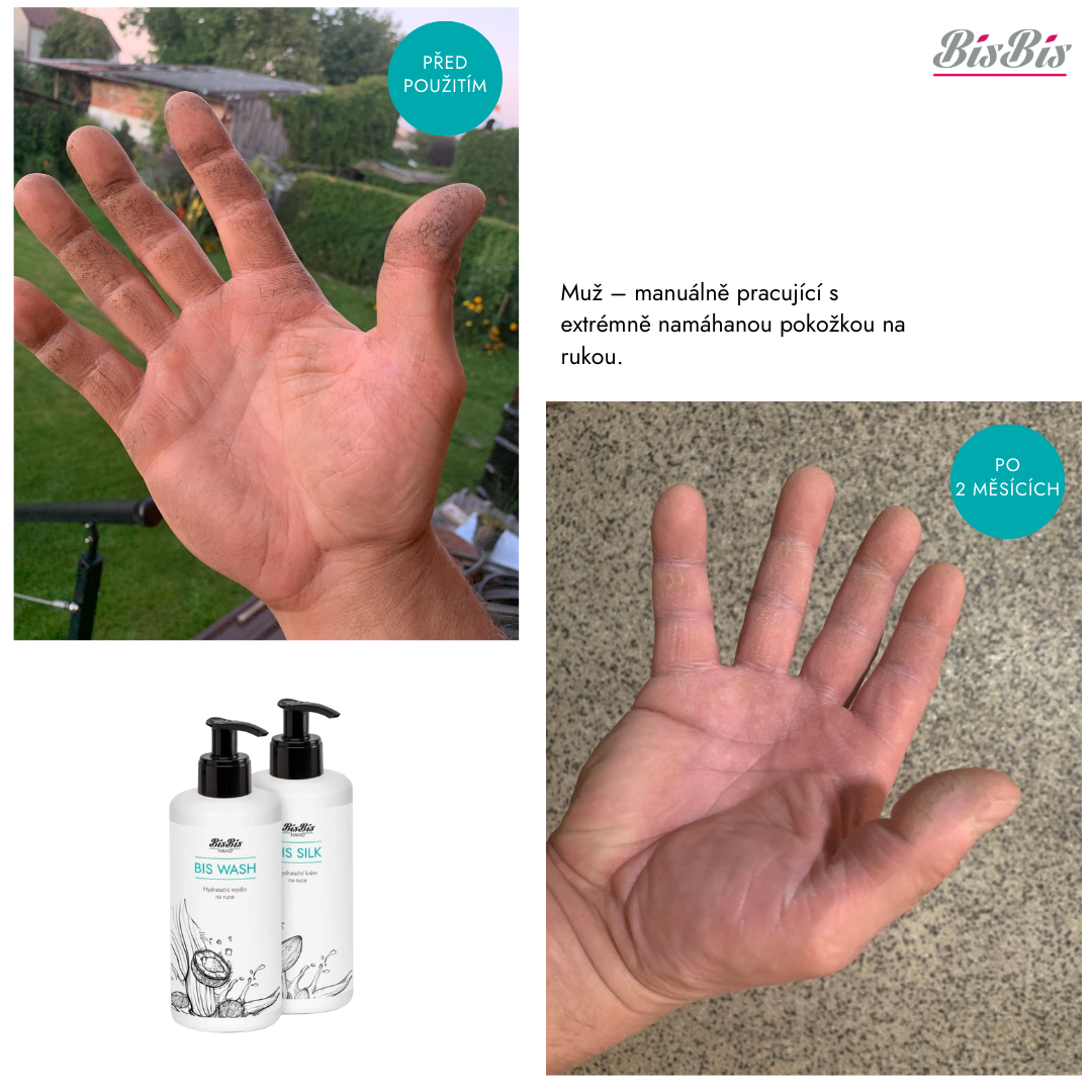 Bis Bis péče o ruce si poradí i s extrémně namáhanou pokožkou