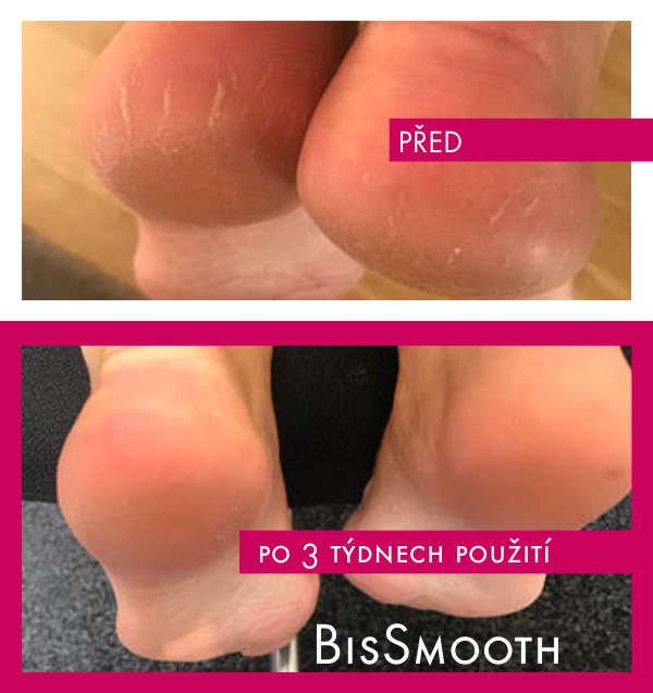 Bis Smooth a mám nohy jako miminko