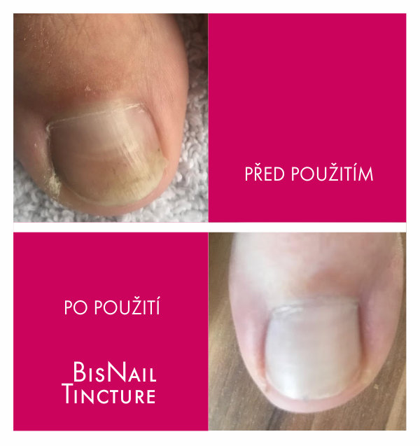 Bis Nail Tincture