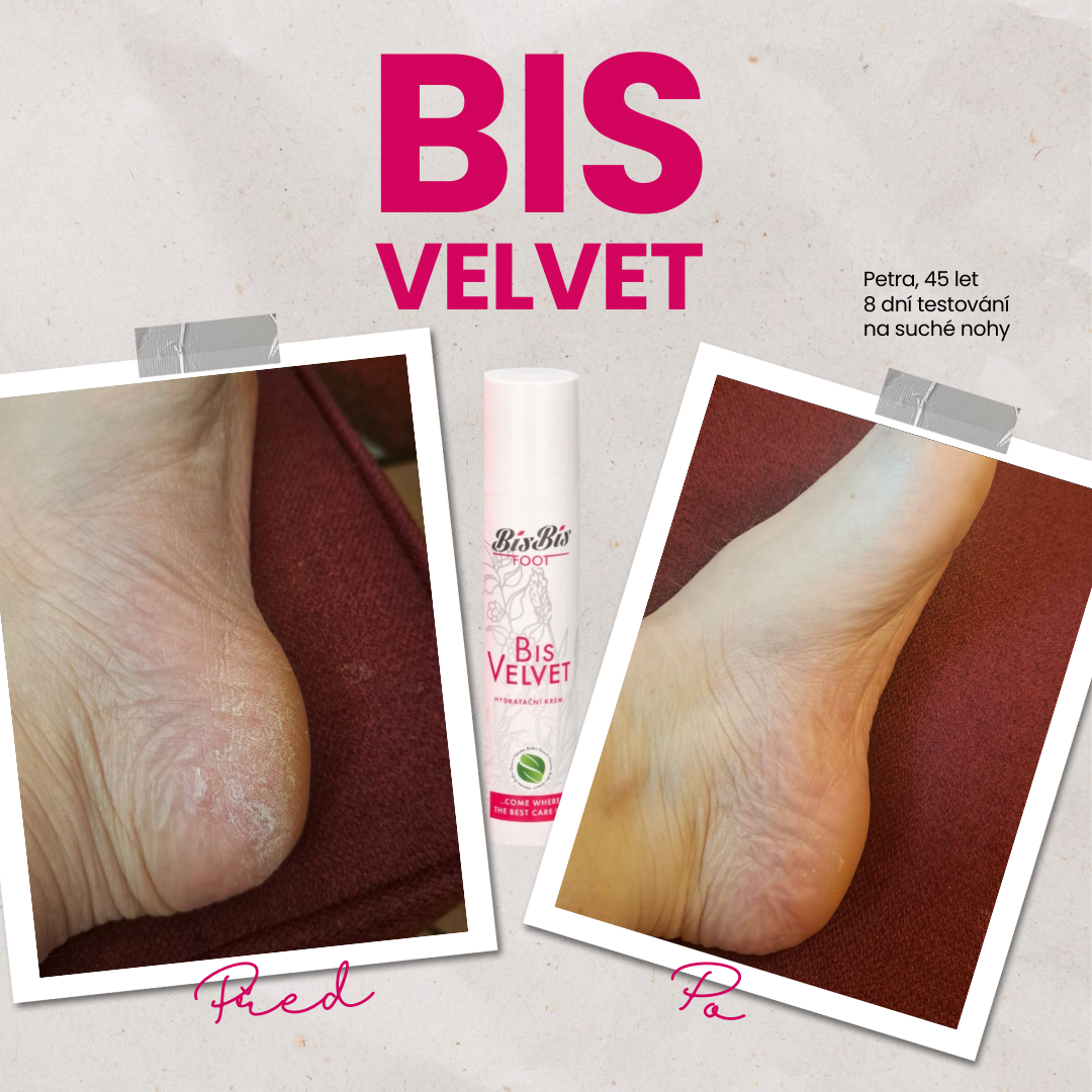 8 dní péče, které proměnily suché a šustivé nohy v hebké