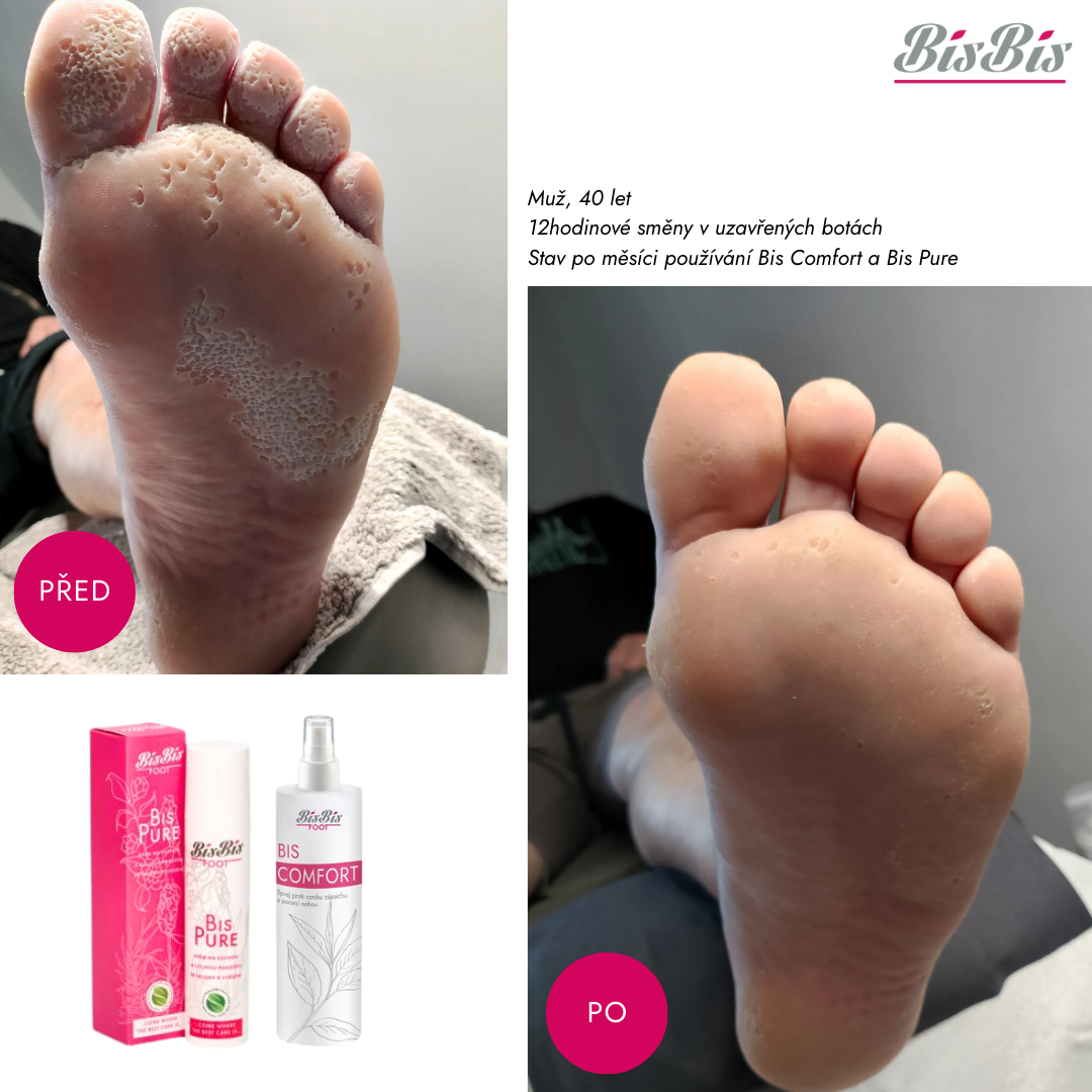 12 hodin denně v botách? Ráno Comfort, večer Pure a výsledek mluví za vše