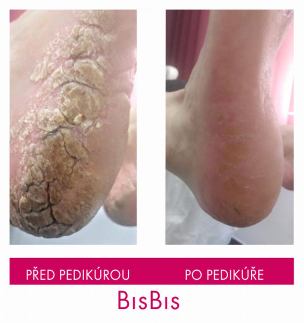 bisbis_pred_po_pedikura_01