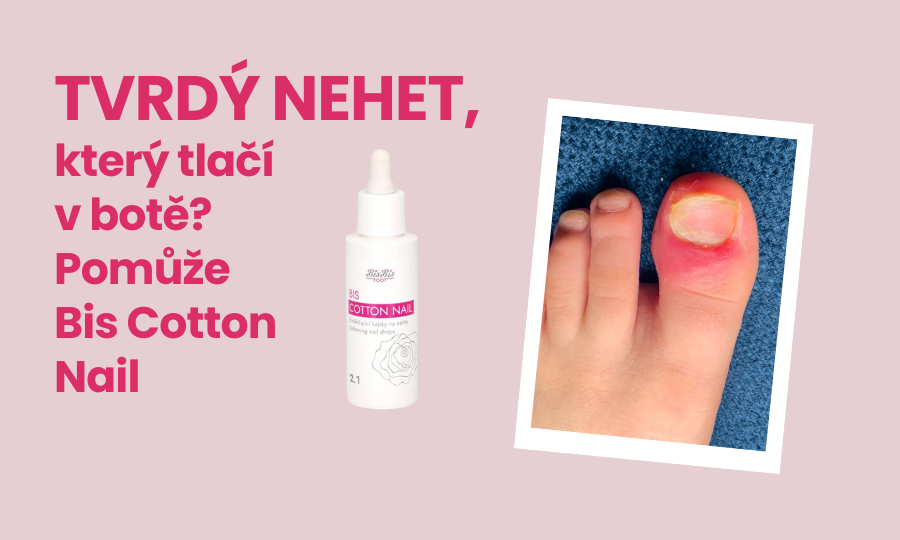 Tvrdý nehet, který tlačí v botě? Uleví vám Bis Cotton Nail