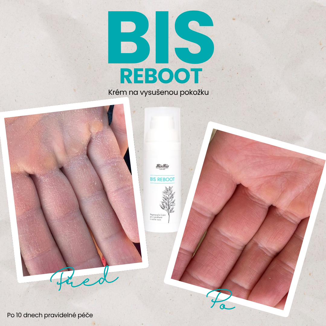 Bis Reboot