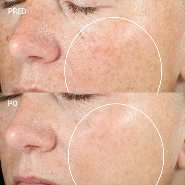 StriVectin-Super-C-Retinol-Brighten-Correct-Vitamin-C-Serum-AURO_5-600px-before_after