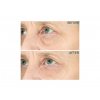 428 3 strivectin hyperlift eye instant eye fix aurio 5