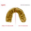 OPRO Instant Custom Fit Jaws Mouthguard