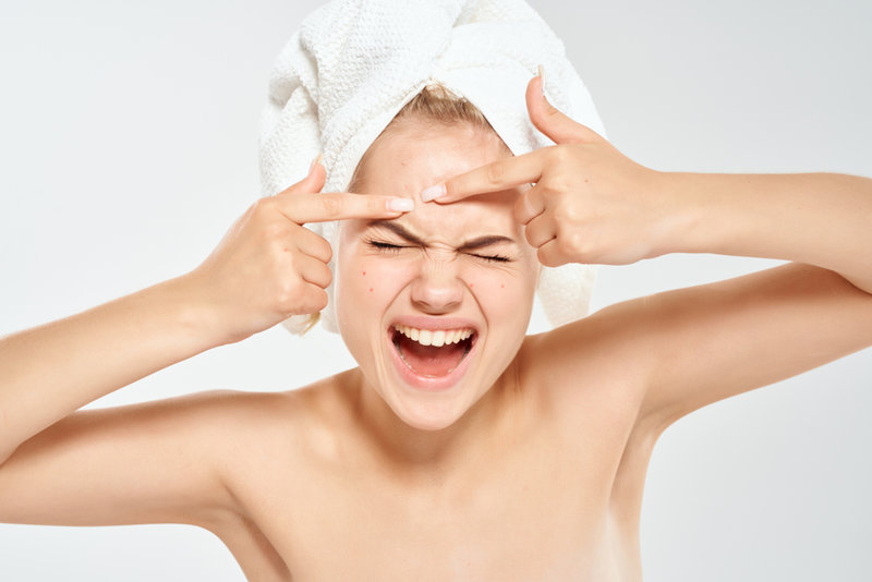 Léčba akné a jizev - jak si lze pomoci doma před návštěvou dermatoložky?