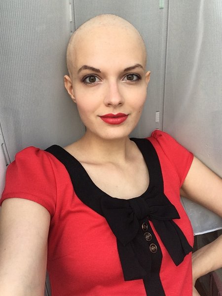 "Rakovina útočí na symboly vašeho ženství," - rozhovor s pacientkou Niki Musilovou