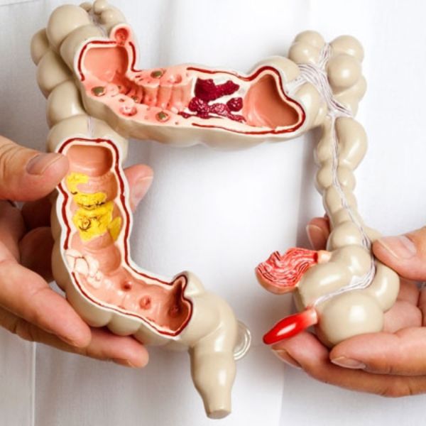 Dráždivý tračník - palčivé projevy, babské rady a zkušenosti s léčbou