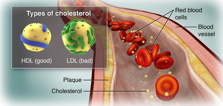 Cholesterol