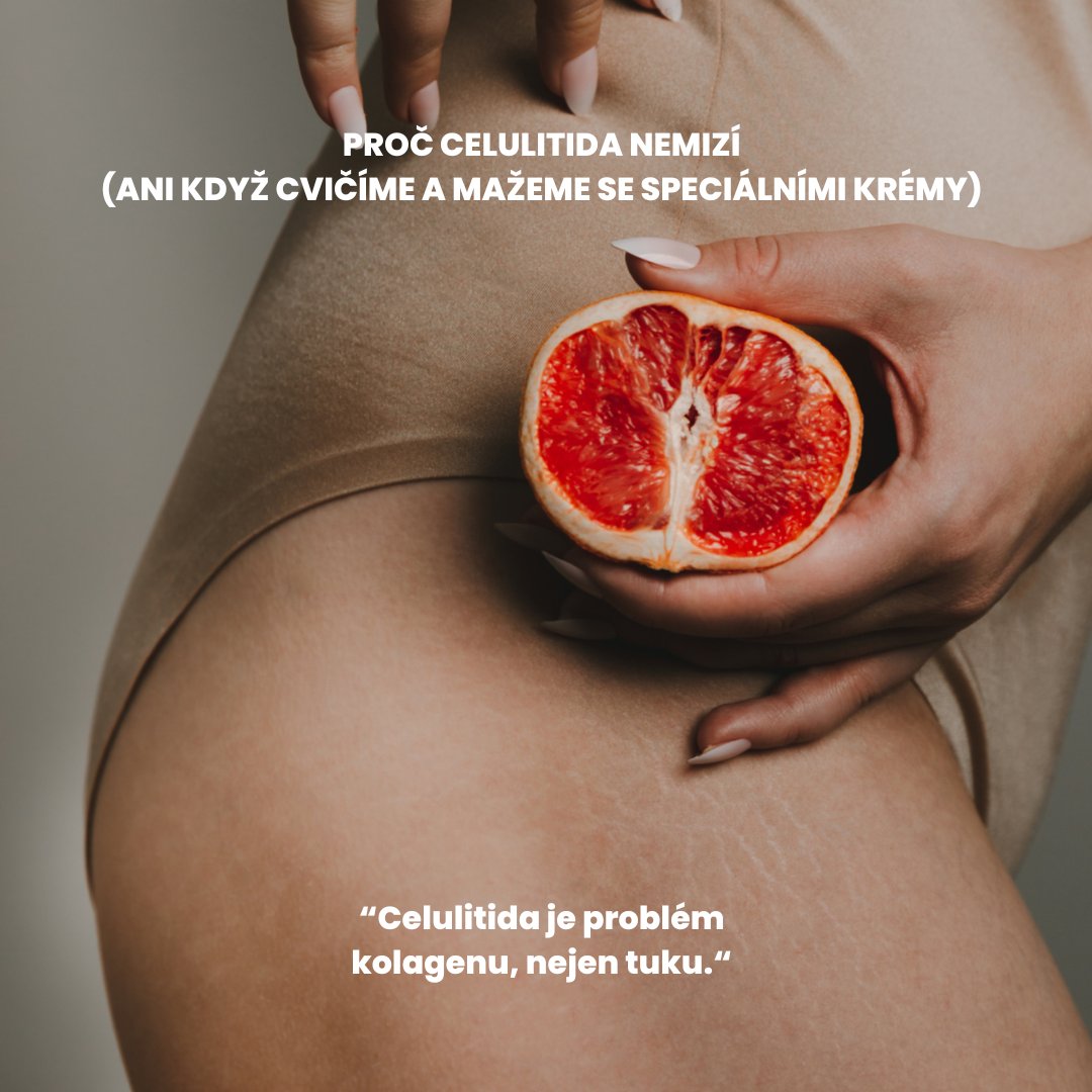 Proč celulitida nemizí