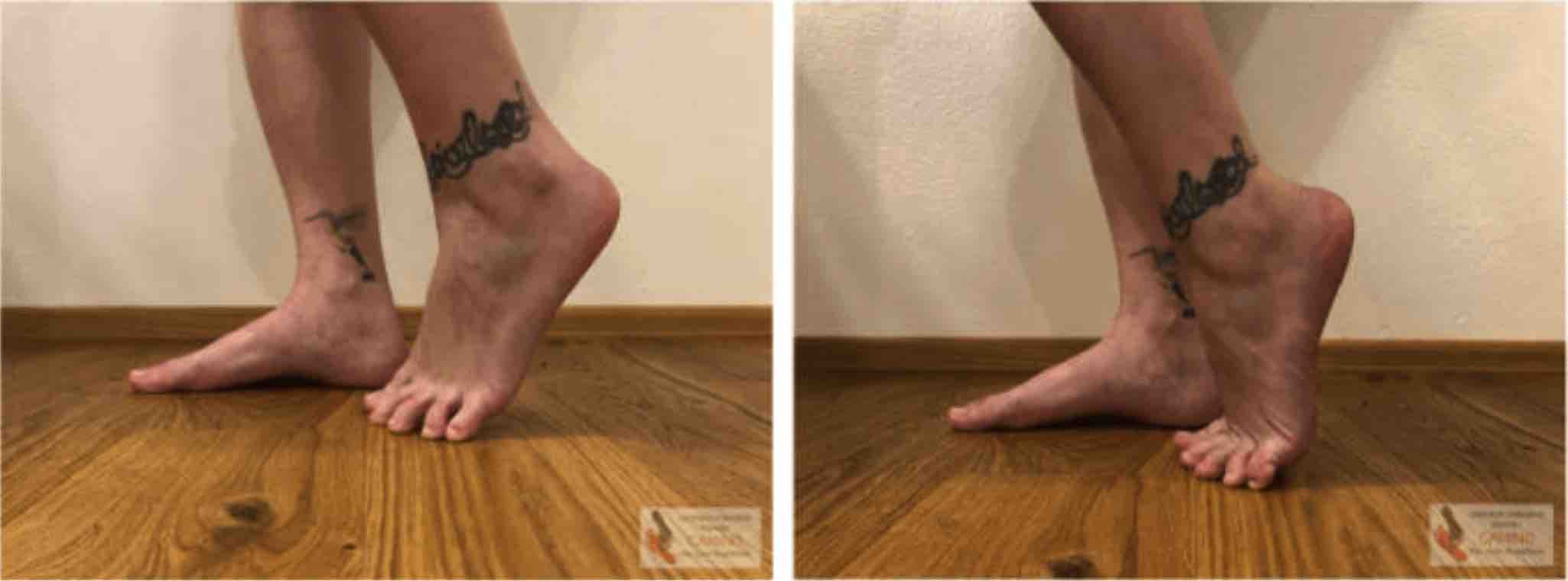 JAK CHODIT V BAREFOOT BOTÁCH