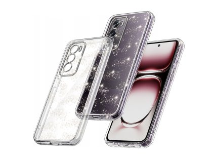 Techsuit - SparkleSkin Series - Oppo Reno12 - Clear