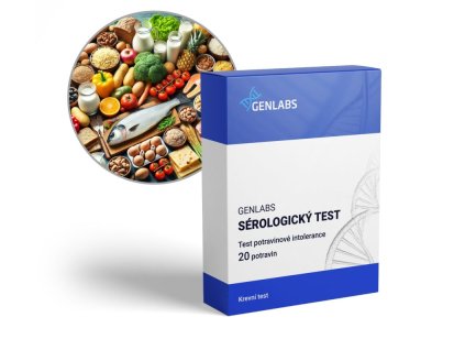 potravinova intolerance 20potravin 900x795