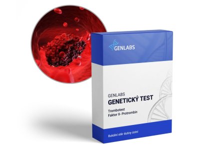 153 trombotest faktor2 1200x1060