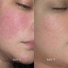 Eco by Sonya Glory Oil Before After 1