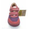 Protetika - Kimberly Purple