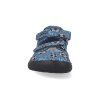 TAFI BALL barefoot detske sandaly protetika tafi ball 3