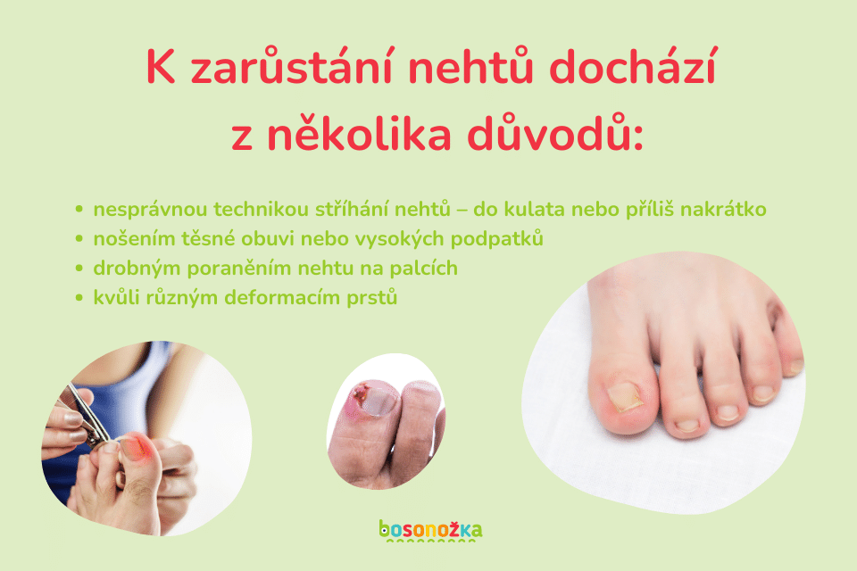 Co na zarůstání nehtů?