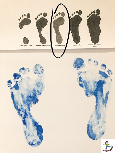 Otisk klenby 3-letého dítěte, které nosí barefoot boty od narození
