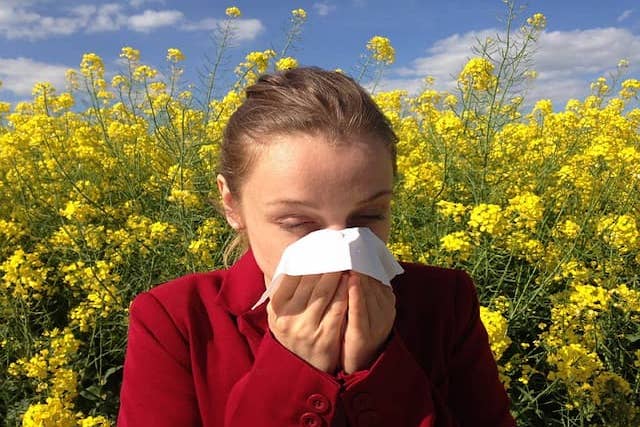 Peľová alergia: Ako zmierniť príznaky prírodnou cestou