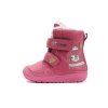 W071 52381 Dark Pink 01