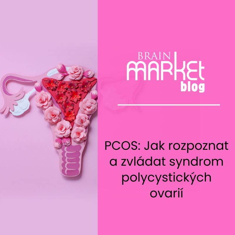 PCOS: Jak rozpoznat a zvládat syndrom polycystických ovarií