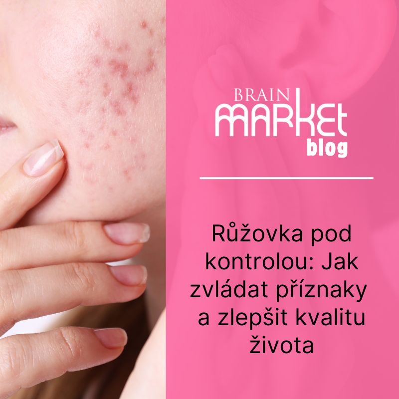 Růžovka pod kontrolou: Jak zvládat příznaky a zlepšit kvalitu života