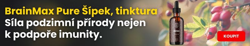 Šípky