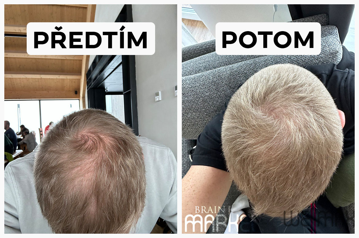 predtým potom wellmax