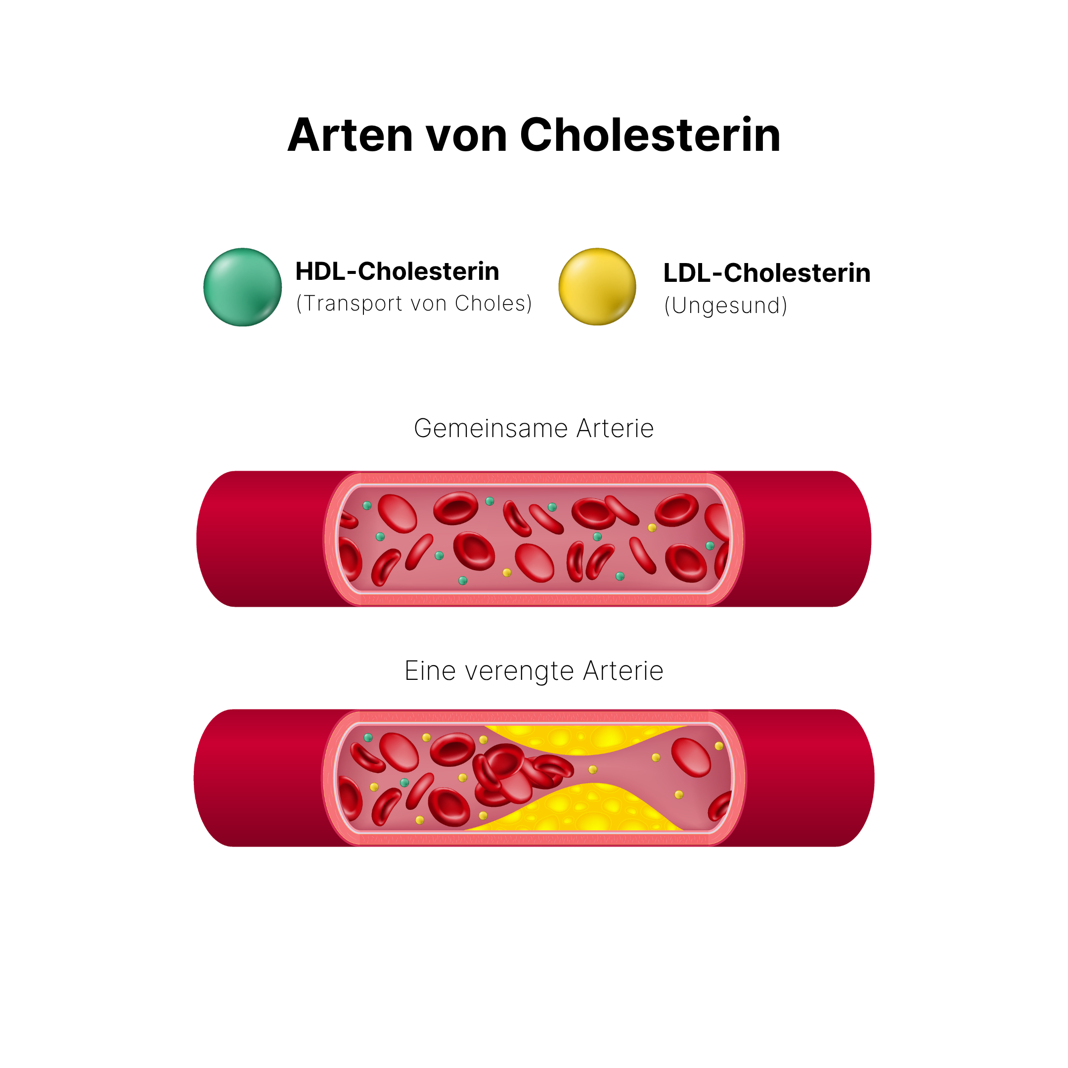 brainmax_cholesterol_support_cevy.png