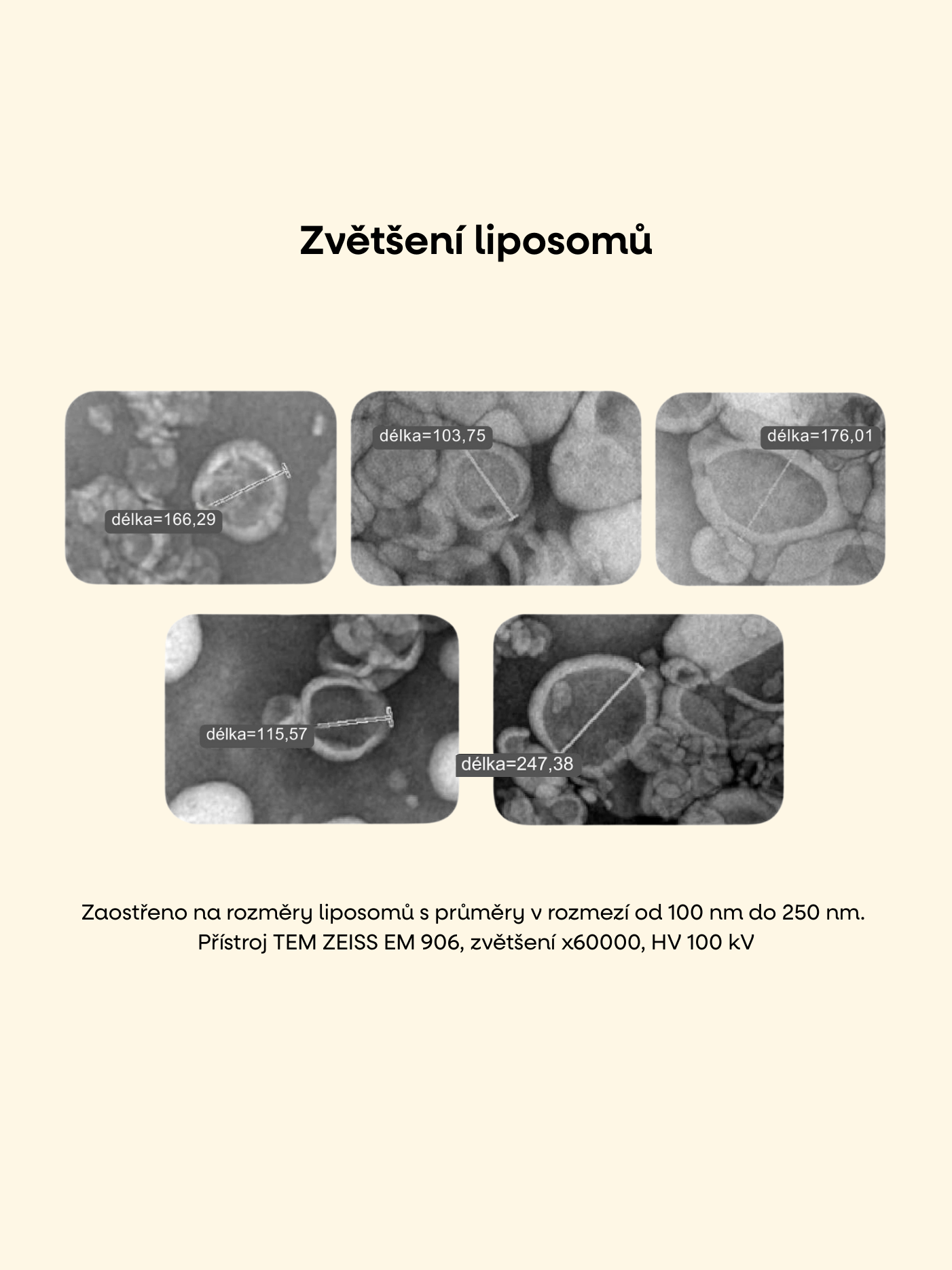 microscopliposom.png