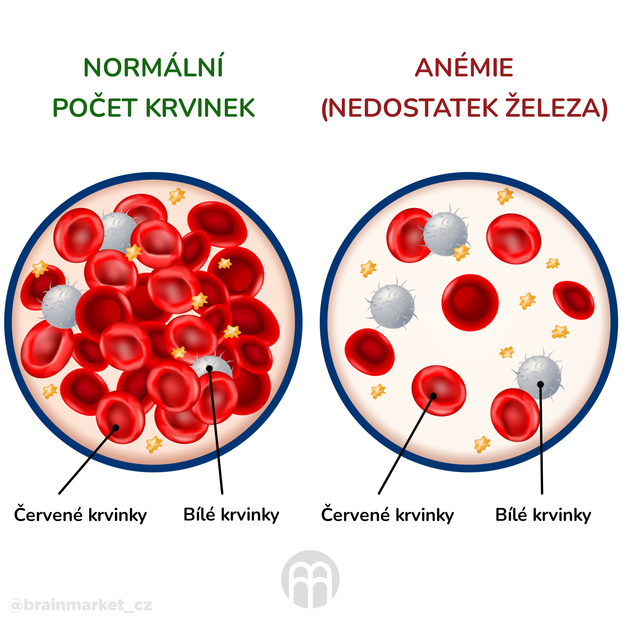 anemie_infografika_cz