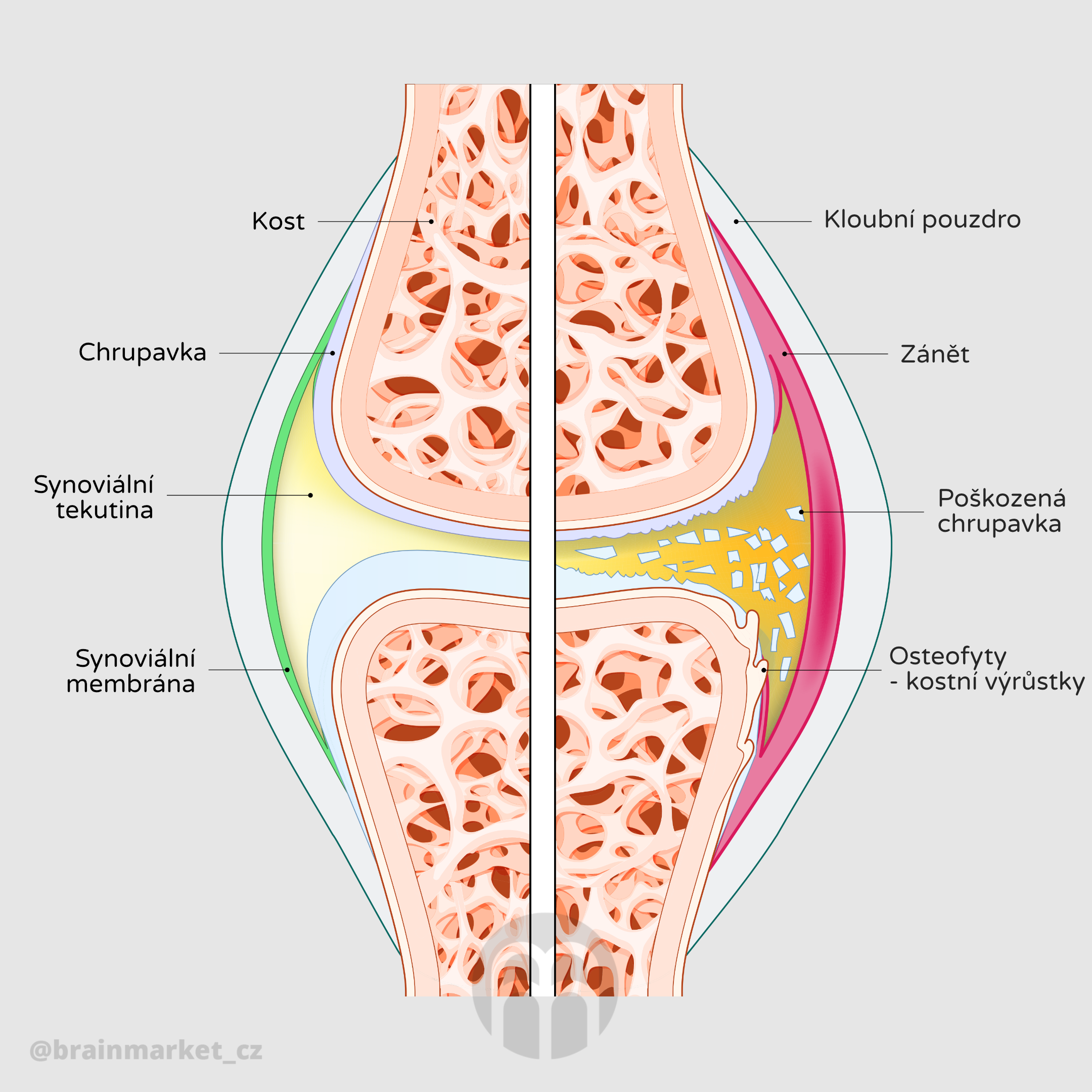 kloub_infografika_Cz