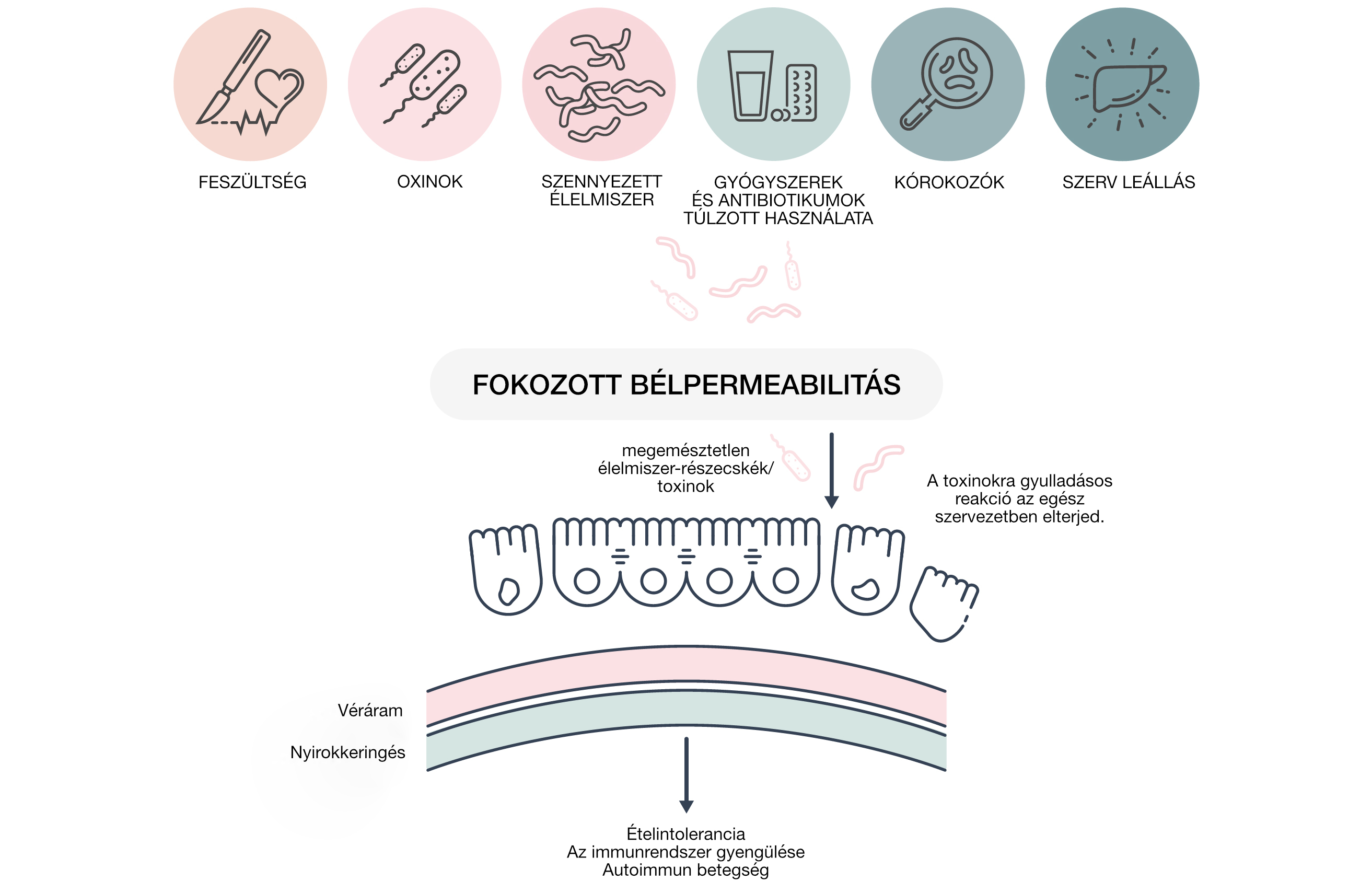 syndrom-propustneho-streva-eccevita_hu